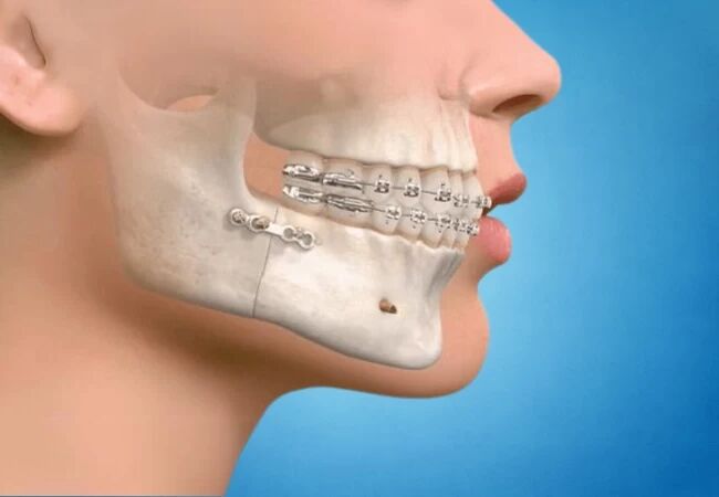 Maxillofacial Surgery in Hubli: What Patients Should Know Before Their First Visit