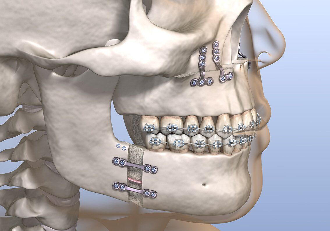 Understanding Maxillofacial Surgery: Expert Insights from Dr. Tejesh Yelamali, Oral & Maxillofacial Surgeon in Hubli